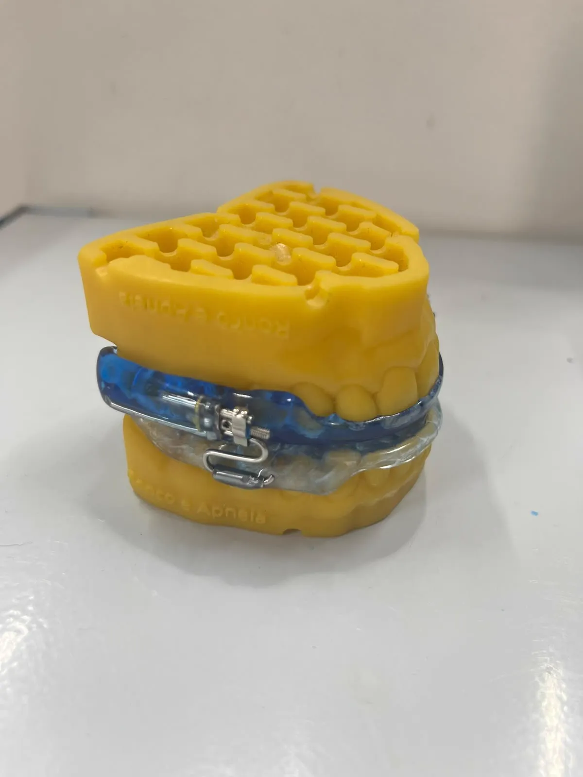 Modelo dental com aparelho intraoral para apneia do sono